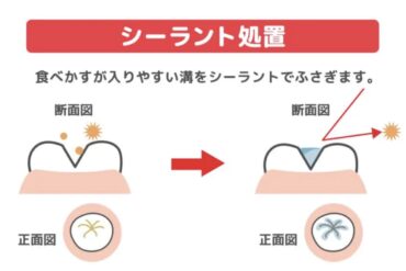 ご予約に関するお願い🦷