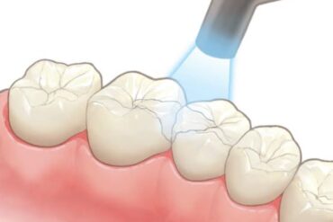 定期検診について🦷
