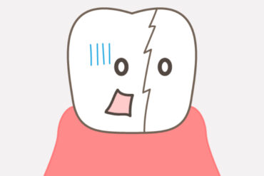 歯は常に動いている？🧚‍♂️