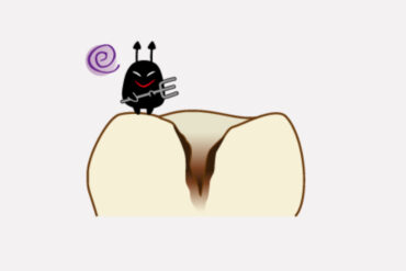 タンパク質と歯の関係