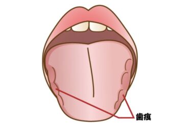 森本歯科の物品🪥