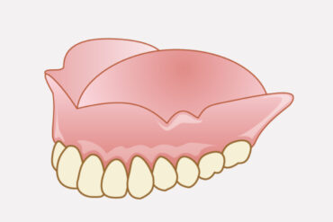 歯を抜いた後