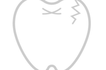 歯の神経の処置はなぜ回数がかかる？