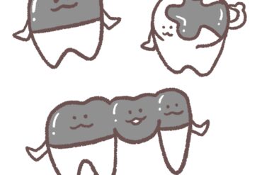 グラつく乳歯について