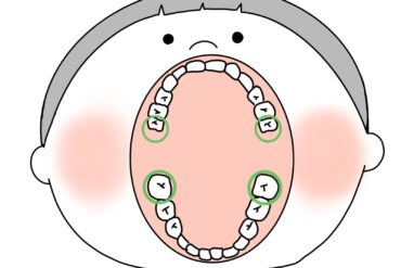 ホームホワイトニング🦷