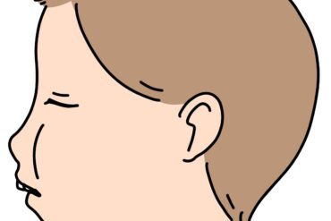 あいうべ体操